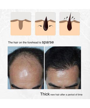 Organic Hair Growth Spray with Onion Oil, Rosemary & Black Seed - Control Hair Loss and Promote Healthy Hair Growth - Buy Online on GoSupps.com