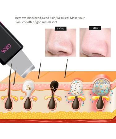 GESS 3-in-1 Microcurrent Facial Device | Skin Scrubber & Face Spatula | 3D Facial Roller Massager | Handheld Skin Toning Device for Home Use - Shop Internationally - Buy Online on GoSupps.com