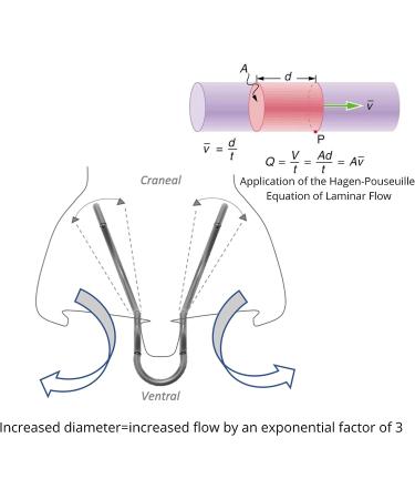 Silent Mammoth Large Nasal Dilator - Reusable & Adjustable for Easy Breathing - Buy Online on GoSupps.com