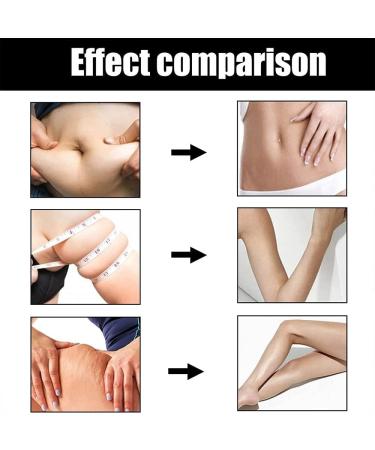 Blusom Celluremove Massage Oil - Moisturizing Body-Fitting & Lifting Oil for All Skin Types | Promotes Blood Circulation | 3PCs - Buy Online on GoSupps.com