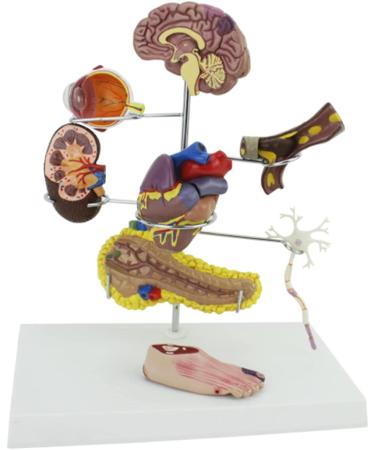 Diabetes Model Set Diabetes ICal Model Human Organ Coronary Artery Thrombosis Model Arteriosclerosis in Vitro