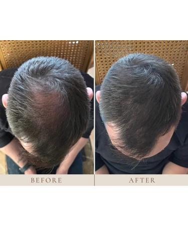 Plume Natural Instant Hairline Scalp Stick - Vegan Clean Beauty for Luscious Hair & Lashes (Blonde 1.5g) - Shop Internationally - Buy Online on GoSupps.com