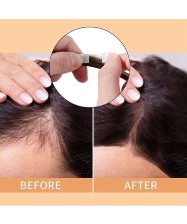 SOFORFREEM 72Pc/Lot Adhesive Extension Hair Strips Super Strong Hair System Tape for Toupees/Lace Wig Film Slitting Line - Buy Online on GoSupps.com