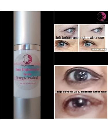 Advanced Anti-Aging Eye Treatment Serum for Rapid Reduction of Under-Eye Bags, Wrinkles, and Fine Lines - Brightening Formula with Niacinamide and Hyaluronic Acid - Buy Online on GoSupps.com