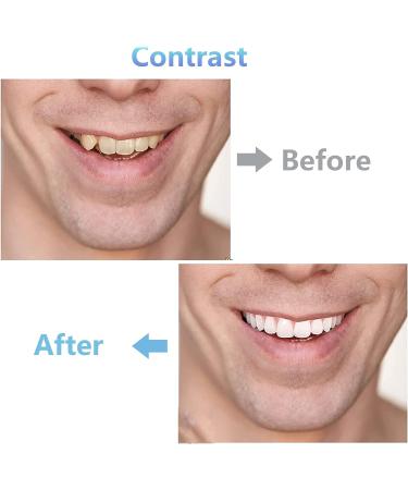 Temporary Tooth Repair Kit - 6PCS Fake Teeth Filling for Fixing Missing & Broken Tooth - Natural Shade - Buy Online on GoSupps.com