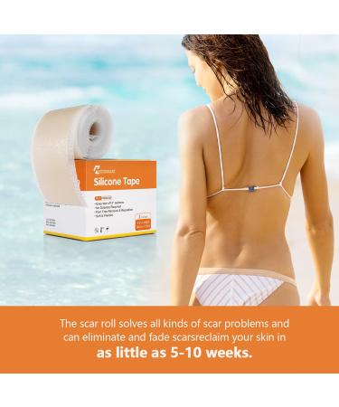 Medical Grade Silicone Scar Tape Roll - Postpartum Belly Band for Scars, Keloids, Burns & Thyroid - 1.6 x 60 | Effective Scars Removal Solution - Buy Online on GoSupps.com