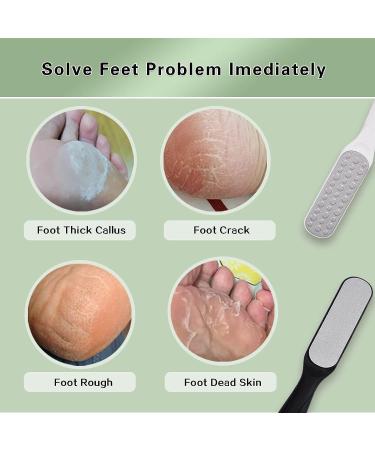 Feiccier Stainless Steel Double-Sided Foot Files - Professional Callus Remover for Cracked Heels, Corns, and Dead Skin - 2 Pcs Set - Buy Online on GoSupps.com