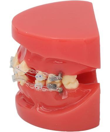 Buy Ververt Touch Ceramic Dental Orthodontic Bracket Model - 24 Teeth Demo Model for Teacher Training | International Shipping Available - Buy Online on GoSupps.com
