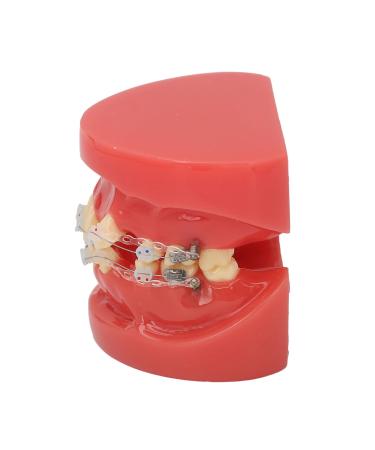 Orthodontic Model Orthodontic Demonstration Model 24 Teeth Metal Wire Case for Dental Hospital for