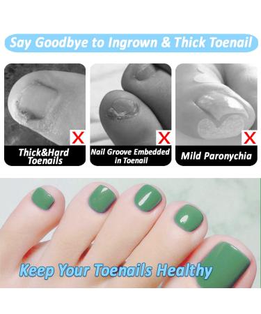 Painless Podiatrist Toenail Clippers for Thick Nails - Professional Ingrown Toenail Tool Kit for Adults & Seniors - Stainless Steel Super Sharp Blade (Black) - Buy Online on GoSupps.com