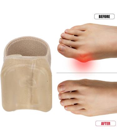 6 Pairs Toe Separators for Overlapping Toes | Elastic SEBS | Reduce Pressure & Prevent Friction | Soft Toe Corrector & Big Toe Alignment Spacer for Hammertoes, Bunions, Sports - Buy Online on GoSupps.com