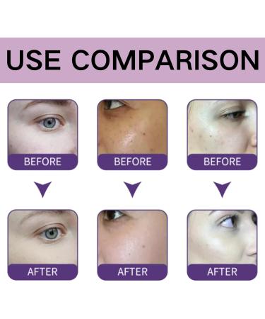 Dark Spot Correcting Glow Serum - Face Serum for Women - Hydrating Serum for Moisturizing Smoothing Firming - Tone Balancing Essence - Dark Spot Remover for Face - Face Care&Skin Care - Buy Online on GoSupps.com