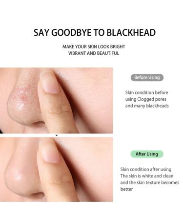 Yuhaever Blackhead Remover Pore Vacuum Kit - Rechargeable, Strong Suction, 4 Probes for Nose & Skin, Face Scrubber - 3 Models - Buy Online on GoSupps.com