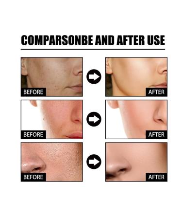 2pcs Nourishing Face Serum Shrinking Pores Brightening Skin Rejuvenation Eye Bags Removing Dark Circles Moisturizing Facial Essence - Buy Online on GoSupps.com