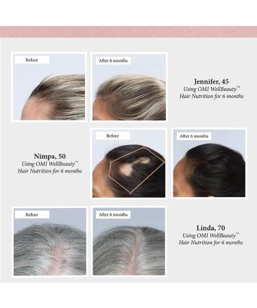 OMI Hair Nutrition Supplement - Clinically Proven for Hair Growth and Reduced Loss - Keratin, Biotin - 1 Month Supply - Buy Online on GoSupps.com