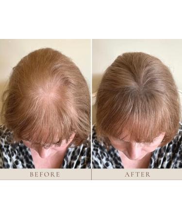 Plume Natural Instant Hairline Scalp Stick - Vegan Clean Beauty for Luscious Hair & Lashes (Blonde 1.5g) - Shop Internationally - Buy Online on GoSupps.com