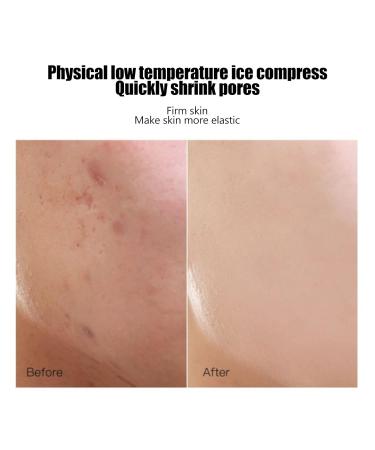 Buy Ice Compress Scooters | Swelling Relief & Skin Repair Mini-Facial Massager for Face Eyes & Neck | Best Beauty Tool Online - Buy Online on GoSupps.com