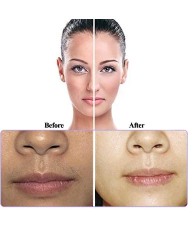 Effective Facial Hair Remover for Women - Manual Epilator with Interchangeable Wires & Storage Bag - Buy Online on GoSupps.com