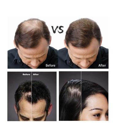 FIBR Hair Keratin Building Fibers for Instant Volume | Thicken Fine & Thinning Hair | Premium Black Hair Fibers for Men & Women - Buy Online on GoSupps.com