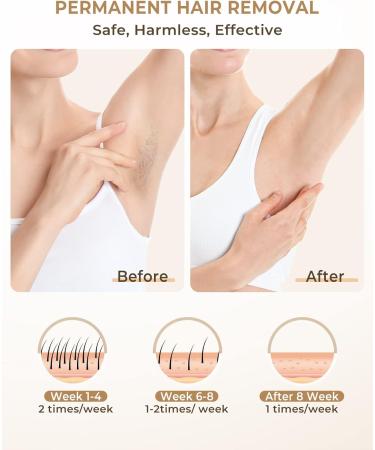 IPL Hair Removal Laser Device - Pain-Free 9 Energy Levels 3 Functions 999 900 Impulses for Men & Women - Face Legs Armpits & Body - Buy Online on GoSupps.com