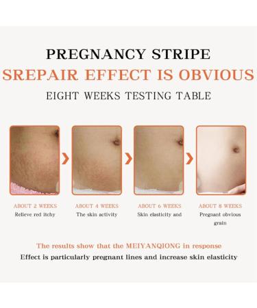 Stretch Mark Cream - Body Skin Care - Body Oil for Women - Firming & Lifting Body Oil - Stretch Marks Removal Skin Care Oil - Improves the Appearance of Stretch Marks Restore Skin Elasticity Body Oil - Buy Online on GoSupps.com