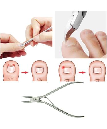 SJLS 2Pcs/Set Ingrown Toe Nail Correction Nippers Clipper Cutters Dead Skin Dirt Remover + Paronychia Podiatry Pedicure Care Tool (Color : A) - Buy Online on GoSupps.com