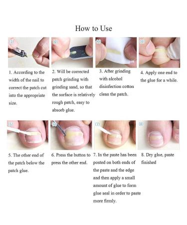 Ingrown Toenail Corrector Strips - 10pcs Bottle, Straightener Clip for Thick Toenails - Foot Tool for Correction - Buy Online on GoSupps.com