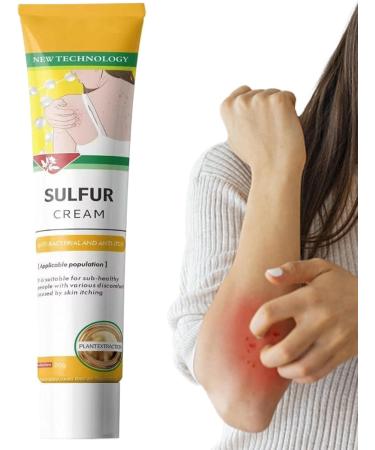  Monozoz Anti-itch cream soothing treatment 20g fast-absorbing balm for combination oily and sensitive skin post-sports recovery outdoor use - Buy Online on GoSupps.com