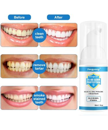 Fengyang 2Pcs Foam Toothpaste - Whiter Teeth Mousse Foam Deep Cleaning & Stain Removal - Buy Online on GoSupps.com