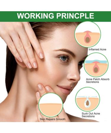 Acne Healing Patches - Invisible Skin Treatment Stickers | 24 Pack for Fast Acne Relief - Buy Online on GoSupps.com