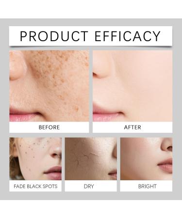 TS TAC-SKY Moisturizing Face Serum - Hydrating Formula To Fade Dark Spots Acne Scars & Brighten Uneven Skin Tone(2PCS) - Buy Online on GoSupps.com