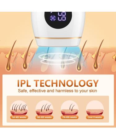 myupszmi IPL Hair Removal Device for Women - Permanent Laser Hair Removal - Face & Body - G888 - Buy Online on GoSupps.com