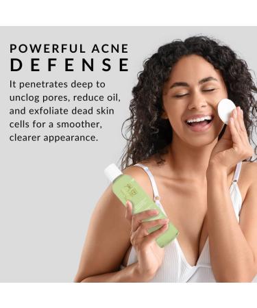 Double O Complex Astringent by Flori Roberts | 20% Salicylic Acid Acne Treatment | Clear Blemishes & Cleanse Pimples - International Shipping Available - Buy Online on GoSupps.com