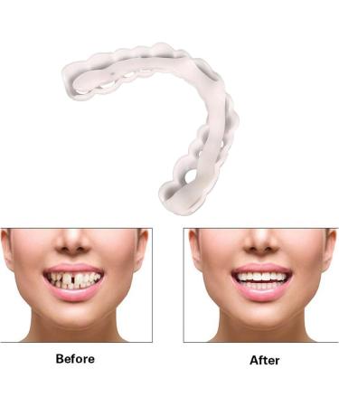 Buy Instant Perfect Snap-On Veneers - 2 Couple Lightening Dentures Prostheses | Teeth Whitening Kit & False Teeth - Buy Online on GoSupps.com
