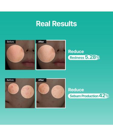 Meditherapy PDRN Skin Booster Serum Centella PDRN & D-Panthenol for Redness Relief and Rejuvenation Gentle Cica Facial Serum for Sensitive Care Korean Skin Care 100 ml (3.38 fl.oz) - Buy Online on GoSupps.com