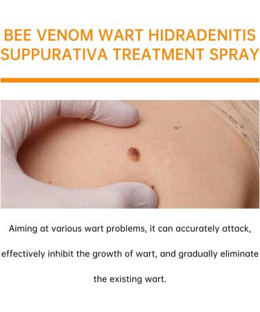 Beauty Grain Removal - Anti-Skin Spray | Fast Acting Natural Liquid with Plant Extracts 20ml Painless Skin Lightening for Back Legs Hands Feet - Buy Online on GoSupps.com