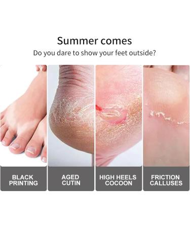 Foot Peel Mask 2 Pairs milk Exfoliating Foot Mask Peel For Dead Skin mild Formula Moisturising Brightening Socks Callus Remover Foot Mask Baby Soft Smooth Touch Feet - Buy Online on GoSupps.com