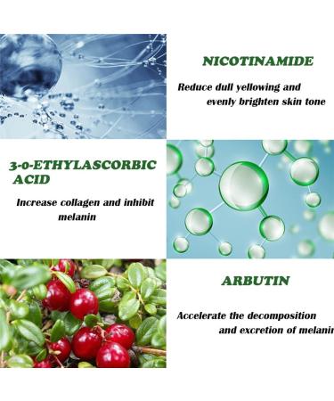 Dr. Hancy White Spot Corrector Cream for Dry Skin - Freckle Whitening & Moisturizing Face Cream (1PCS) - Buy Online on GoSupps.com