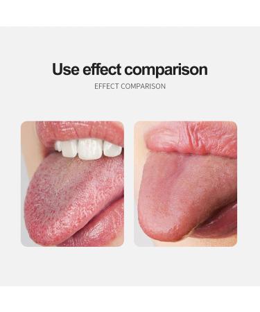 Monnadu Stainless Steel Tongue Scraper - Professional Tongue Cleaner for Fresher Breath | Rose Gold Metal Tongue Scraps to Reduce Bad Breath | Perfect for Adults - Buy Online on GoSupps.com