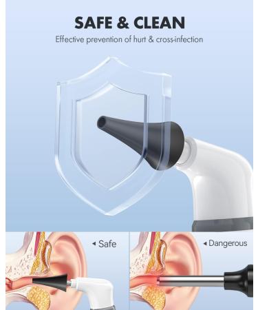 Anykit Wireless Otoscope Ear Camera - Dual View 3.9mm 720PHD WiFi Ear Scope with Ear Wax Removal Tool for Kids, Adults & Pets - Compatible with Android and iPhone - Buy Online on GoSupps.com