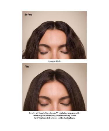 Aveda Invati Ultra Advanced Fortifying Leave-In Treatment | 3.4 OZ - Best International Shipping - Buy Online on GoSupps.com