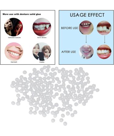 Jojomi Thermo-Pearl Tooth Veneer Set | Temporary Denture Repair for Broken Missing & Uneven Teeth - 10g - Buy Online on GoSupps.com