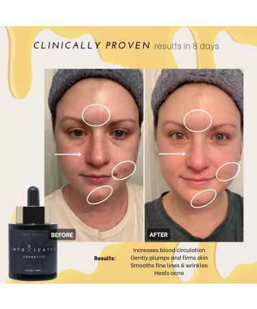 Bee Serum - Anti-Aging & Acne Treatment | Purified Bee Venom Niacinamide Vitamin C + E Hyadisine | Breakout Prevention - Shop Now - Buy Online on GoSupps.com