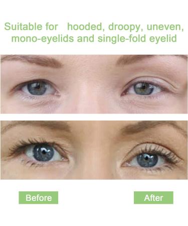 Invisible Eyelid Lift Strips 480pcs Set - Self-Adhesive Eye Lid Correction Tape for Saggy, Hooded, Droopy Eyelids - Skin Tone, One-Sided Sticky - Sizes S & L - Buy Online on GoSupps.com
