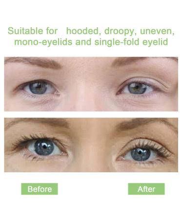 Double Eyelid Ligaments - Invisible Eyelid Stripes for Sagging Eyelids | Self-Adhesive Correction Strips | 24-Hour Durability Beauty Tool - Buy Online on GoSupps.com