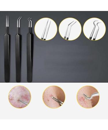 LANTRO JS Pimple Popper Tool Kit 10pcs Blackhead Remover Tool Needles Carbon Steel Comedone Extractor Tools for Removing Pimple Blackheads Zit on Face Acne Removal Kit with Case(Black) - Buy Online on GoSupps.com