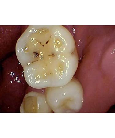 Buy HD Wireless Dental Intraoral Camera - 6MP 6 LED Clear Image for Pet & Human Oral Exams - Buy Online on GoSupps.com