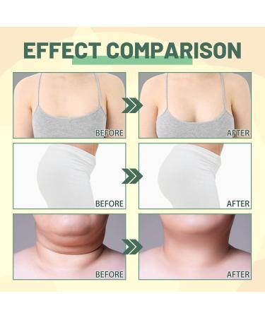  Yunmiao 2 firming body oils with collagen - 30 ml - Firming and toning - For shoulders arms thighs neck and buttocks - Buy Online on GoSupps.com