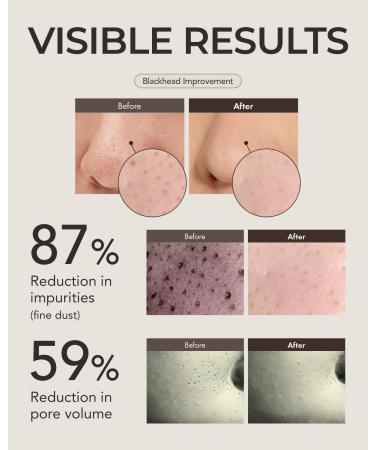 OBgE Blackhead Scrub Balm (0.7oz) - Moisturizing Scrub Stick for Blackhead Removal Pore Minimizing Gentle Exfoliation & Moisturization. Tea Tree Green Tea & Heartleaf. (0.7oz) Pack of 1 - Buy Online on GoSupps.com