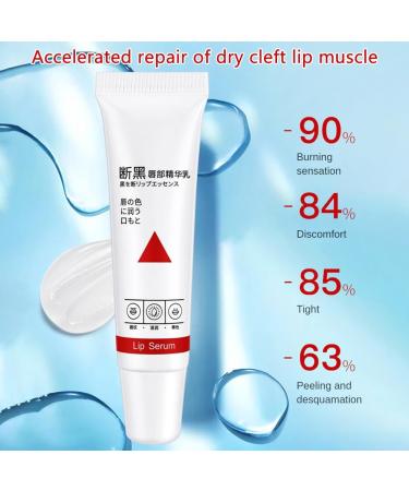 zhiang Lip Whitening for Dark Lips 15ml Lip Whitening for Dark Lips Smoker Lip Whitening Balm Lip Brightening for Dark Lips for Men Women Darkening and Repairing Lip Serum - Buy Online on GoSupps.com